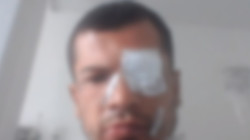 Manizales: La atacó a machete sin importarle su estado de embarazo, enfrenta juicio