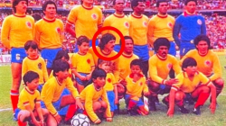 Exfigura de la Selección Colombia, Once Caldas y Millonarios salió del hospital, pero sigue en estado delicado