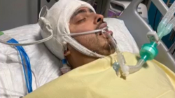 Colombiano en París sobrevive a brutal ataque tras ayudar a un compatriota: su historia es viral en redes